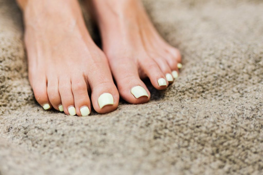 Füße mit lackierten Fußnägeln. Im Artikel: Fußnägel unbedingt richtig schneiden